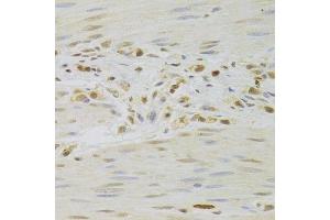 Immunohistochemistry (Paraffin-embedded Sections) (IHC (p)) image for anti-PRP3 Pre-mRNA Processing Factor 3 Homolog (PRPF3) (AA 1-280) antibody (ABIN6146260)