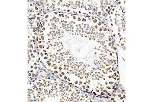 Immunohistochemistry of paraffin embedded mouse testis using PTPN3 (ABIN7075298) at dilution of 1:700 (300x lens) (PTPN3 Antikörper)