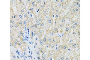 Immunohistochemistry of paraffin-embedded Human liver using SLC19A1 Polyclonal Antibody at dilution of 1:100 (40x lens). (SLC19A1 Antikörper)