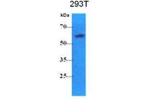 Western Blotting (WB) image for anti-Pyruvate Kinase, Liver and RBC (PKLR) antibody (ABIN781545) (PKLR Antikörper)