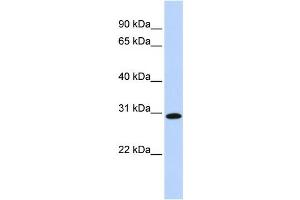 Western Blotting (WB) image for anti-Survival Motor Neuron Domain Containing 1 (SMNDC1) antibody (ABIN2458518)