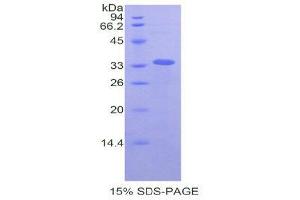 SDS-PAGE (SDS) image for Lysyl Oxidase-Like 4 (LOXL4) (AA 479-756) protein (His tag) (ABIN1080234)