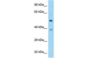 Image no. 1 for anti-tRNA-splicing Endonuclease Subunit SEN2 (TSEN2) (AA 395-444) antibody (ABIN6748165) (TSEN2 Antikörper  (AA 395-444))