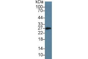 Western Blot; Sample: Mouse Small intestine lysate; Primary Ab: 5µg/ml Rabbit Anti-Mouse CD160 Antibody Second Ab: 0. (CD160 Antikörper  (AA 33-171))