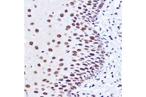 Immunohistochemistry of paraffin-embedded human esophageal using Matrin 3 antibody (ABIN7268415) at dilution of 1:100 (40x lens).