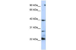 WB Suggested Anti-TNFRSF10B Antibody Titration:  0. (TNFRSF10B Antikörper  (N-Term))
