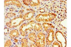 Immunohistochemistry of paraffin-embedded human kidney tissue using ABIN7155729 at dilution of 1:100 (HOXA9 Antikörper  (AA 1-190))