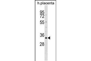 Western blot analysis in human placenta tissue lysates (35ug/lane). (DOK5 Antikörper  (N-Term))