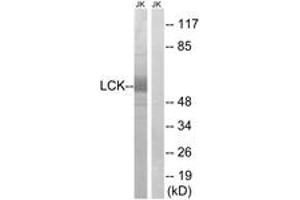 Western blot analysis of extracts from Jurkat cells, using LCK (Ab-59) Antibody. (LCK Antikörper  (AA 26-75))