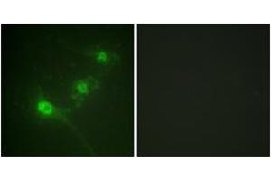 Immunofluorescence analysis of NIH-3T3 cells, using LKB1 (Phospho-Ser428) Antibody. (LKB1 Antikörper  (pSer428))