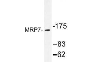Image no. 1 for anti-ATP-Binding Cassette, Sub-Family C (CFTR/MRP), Member 10 (ABCC10) antibody (ABIN317845) (ABCC10 Antikörper)