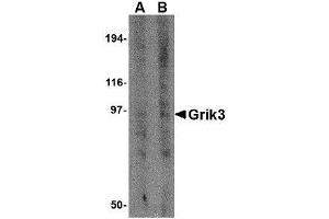 Image no. 1 for anti-Glutamate Receptor, Ionotropic, Kainate 3 (GRIK3) (N-Term) antibody (ABIN1494385) (GRIK3 Antikörper  (N-Term))