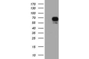 Western Blotting (WB) image for anti-Ribosomal Protein S6 Kinase, 70kDa, Polypeptide 1 (RPS6KB1) antibody (ABIN1500001) (RPS6KB1 Antikörper)