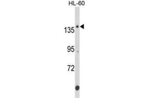 Western blot analysis of FNDC3B Antibody (N-term) in HL-60 cell line lysates (35ug/lane). (FNDC3B Antikörper  (N-Term))