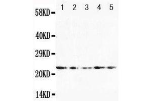 Anti-FGF10 antibody, Western blotting Lane 1: U87 Cell Lysate Lane 2: HELA Cell Lysate Lane 3: A519 Cell Lysate Lane 4: 293T Cell Lysate Lane 5: HELA Cell Lysate (FGF10 Antikörper  (N-Term))