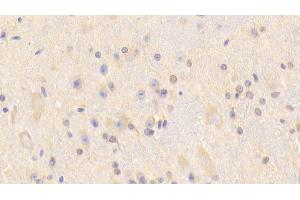 Detection of CARNS1 in Mouse Cerebrum Tissue using Polyclonal Antibody to Carnosine Synthase 1 (CARNS1) (CARNS1 Antikörper  (AA 623-826))