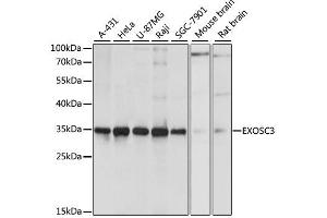 Western blot analysis of extracts of various cell lines, using EXOSC3 antibody. (EXOSC3 Antikörper  (AA 1-275))