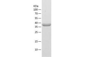 Western Blotting (WB) image for Enoyl-CoA Delta Isomerase 2 (PECI) (AA 31-394) protein (His tag) (ABIN7122796) (PECI/ECI2 Protein (AA 31-394) (His tag))