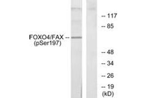 Western blot analysis of extracts from 293 cells treated with serum, using AFX (Phospho-Ser197) Antibody.
