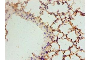 Immunohistochemistry (IHC) image for anti-Vascular Endothelial Growth Factor A (VEGFA) (AA 27-232) antibody (ABIN7179107)