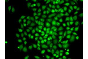 Immunofluorescence analysis of MCF-7 cells using CTCFL antibody. (CTCFL Antikörper)