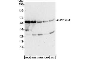 Western Blotting (WB) image for anti-Protein Phosphatase 3, Catalytic Subunit, alpha Isoform (PPP3CA) (C-Term) antibody (ABIN7453555)
