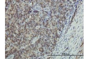 Image no. 1 for anti-Epithelial Membrane Protein 3 (EMP3) (AA 1-164) antibody (ABIN598660) (EMP3 Antikörper  (AA 1-164))