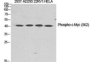 Western Blot (WB) analysis of specific cells using Phospho-c-Myc (S62) Polyclonal Antibody. (c-MYC Antikörper  (pSer62))