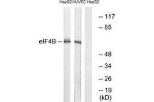 Western blot analysis of extracts from HepG2/HuvEc cells, using eIF4B (Ab-422) Antibody. (EIF4B Antikörper  (AA 388-437))
