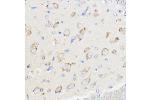 Immunohistochemistry of paraffin-embedded Mouse brain using WBSCR27 Rabbit pAb (ABIN7271366) at dilution of 1:50 (40x lens). (WBSCR27 Antikörper  (AA 1-245))