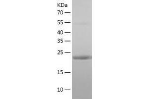 Lin-7 Homolog B (LIN7B) (AA 1-207) protein (His-IF2DI Tag)