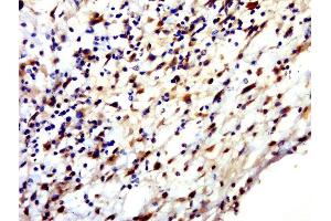 Paraformaldehyde-fixed, paraffin embedded human skin, Antigen retrieval by boiling in sodium citrate buffer (pH6. (HENMT1 Antikörper  (AA 1-100))