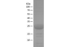 Western Blotting (WB) image for Protein Phosphatase 2 Regulatory Subunit 2A (PPP2R2A) (AA 71-107) protein (His-IF2DI Tag) (ABIN7124671)