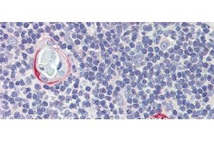 Rabbit Anti-CPXCR1 Antibody Catalog Number: arp39743 Paraffin Embedded Tissue: Human Tymus Antibody Concentration: 10 ug/ml (CPXCR1 Antikörper  (Middle Region))