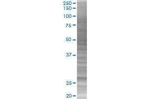Western Blotting (WB) image for CDKN1B 293T Cell Transient Overexpression Lysate(Denatured) (ABIN1331312)