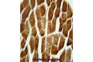 Immunohistochemistry (Paraffin-embedded Sections) (IHC (p)) image for anti-Adaptor-Related Protein Complex 1, sigma 3 Subunit (AP1S3) (AA 15-45), (N-Term) antibody (ABIN950445)
