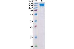 SDS-PAGE (SDS) image for VEGF Receptor 2 (VEGFR2) (AA 20-764) protein (His tag) (ABIN6964112)