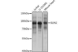 Western blot analysis of extracts of various cell lines, using SUN2 antibody (ABIN7270136) at 1:1000 dilution. (SUN2 Antikörper)