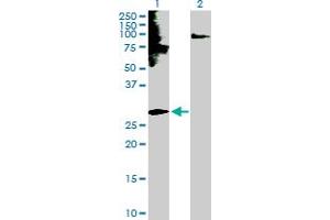 Endothelin 3 Antikörper  (AA 1-238)