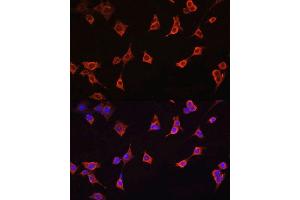 Immunofluorescence analysis of NIH/3T3 cells using CFL1 antibody. (Cofilin Antikörper  (AA 1-100))