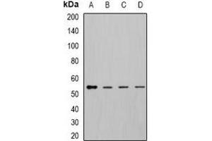 Western blot analysis of DLD expression in MCF7 (A), K562 (B), mouse kidney (C), mouse liver (D) whole cell lysates. (DLD Antikörper)