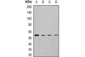 Western blot analysis of DLD expression in MCF7 (A), K562 (B), mouse kidney (C), mouse liver (D) whole cell lysates. (DLD Antikörper)