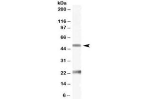 Western blot testing of human ovay lysate with Fibulin 5 antibody at 0. (Fibulin 5 Antikörper)