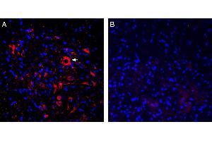 Expression of ASIC2a in rat spinal cord. (ACCN1 Antikörper  (Intracellular, N-Term))