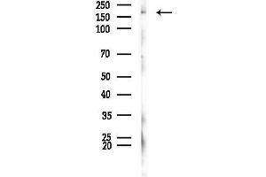 Western blot analysis of lysates from Rat brain, using SCN7A Antibody at 1/1000 dilution.