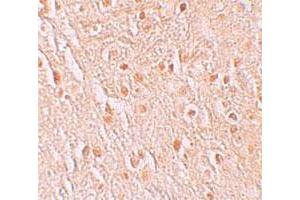 Immunohistochemical staining of human brain cells with PION polyclonal antibody  at 5 ug/mL. (GSAP Antikörper  (C-Term))