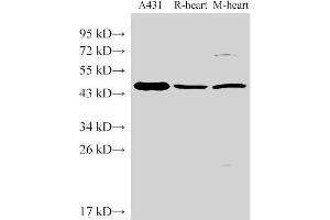 Western Blot analysis of 1)A431, 2)Rat heart, 3)Mouse heart using SERPINB2 Polyclonal Antibody at dilution of 1:1000 (SERPINB2 Antikörper)