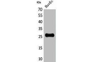 Western Blot analysis of HuvEc cells using CacyBP Polyclonal Antibody. (CACYBP Antikörper  (C-Term))