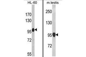 (LEFT) Western blot analysis of NLRP12 Antibody in HL-60 cell line lysates (35ug/lane). (NLRP12 Antikörper  (C-Term))