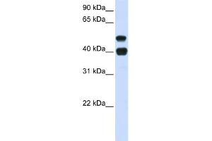WB Suggested Anti-USP22 Antibody Titration: 0.